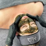 Bio Peel kruidenpeeling behandeling bij AV PMU in Wateringen